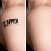 Dr. Klaudia Hauer Tattoo Entfernung